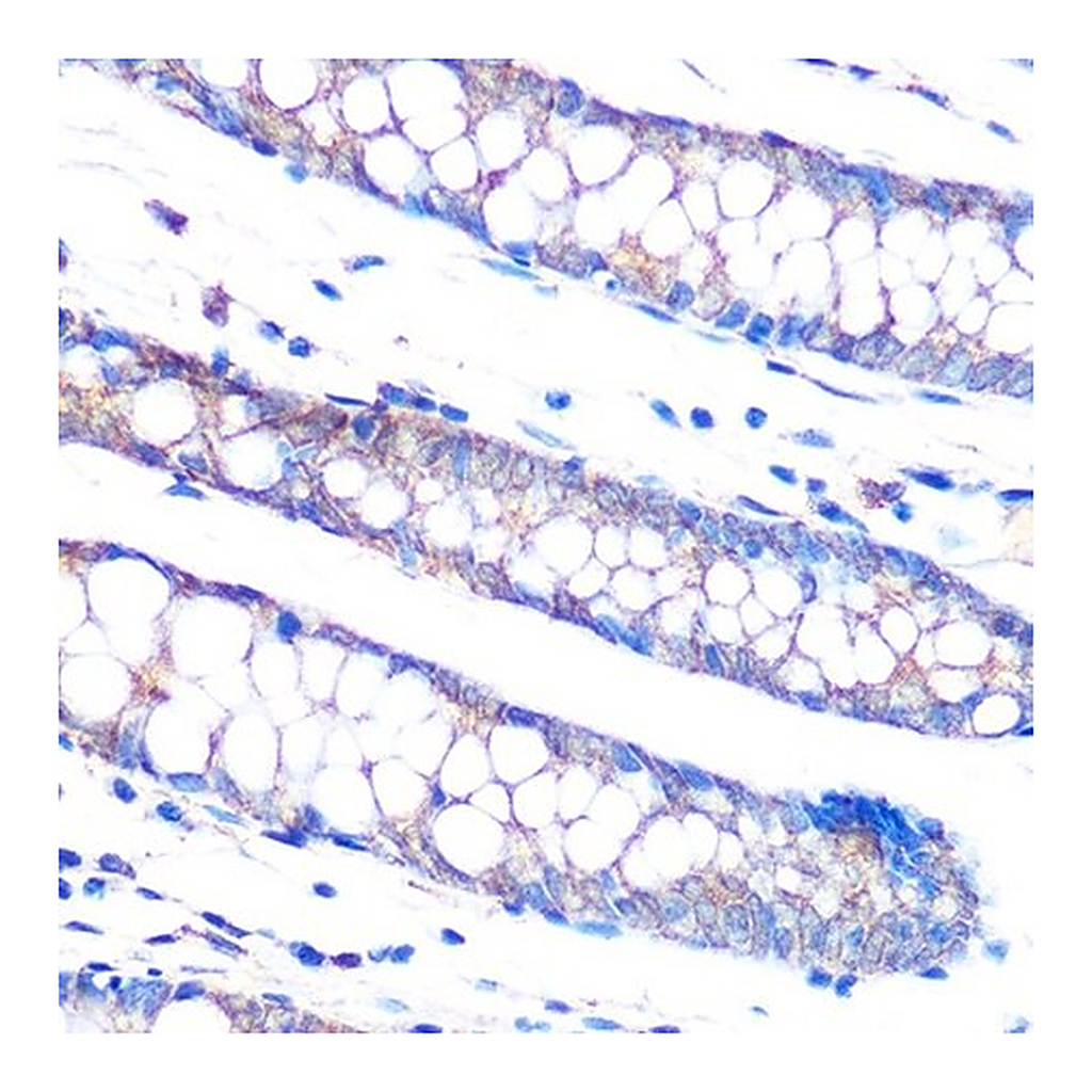 Merck Anti-DUSP6 antibody produced in rabbit