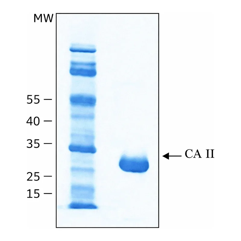 Merck CARBONIC ANHYDRASE II BOVINE RECOMBIN&