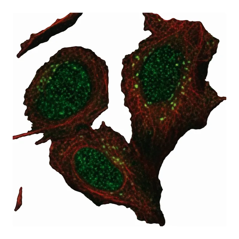 Merck Anti-ANKRD40 antibody produced in rabbit