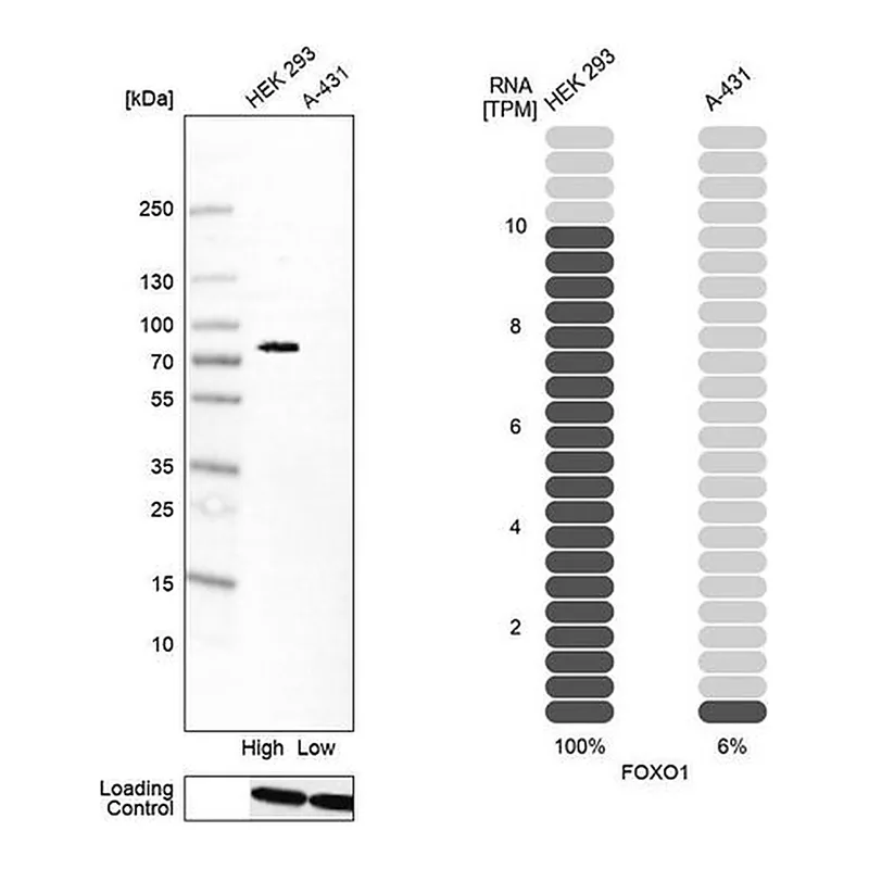 Merck Anti-FOXO1 antibody produced in mouse