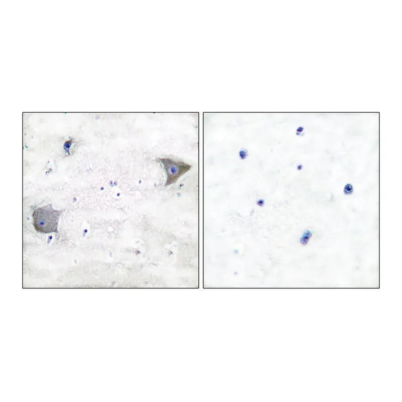 Merck Anti-PDGFR alpha antibody produced in rabbit