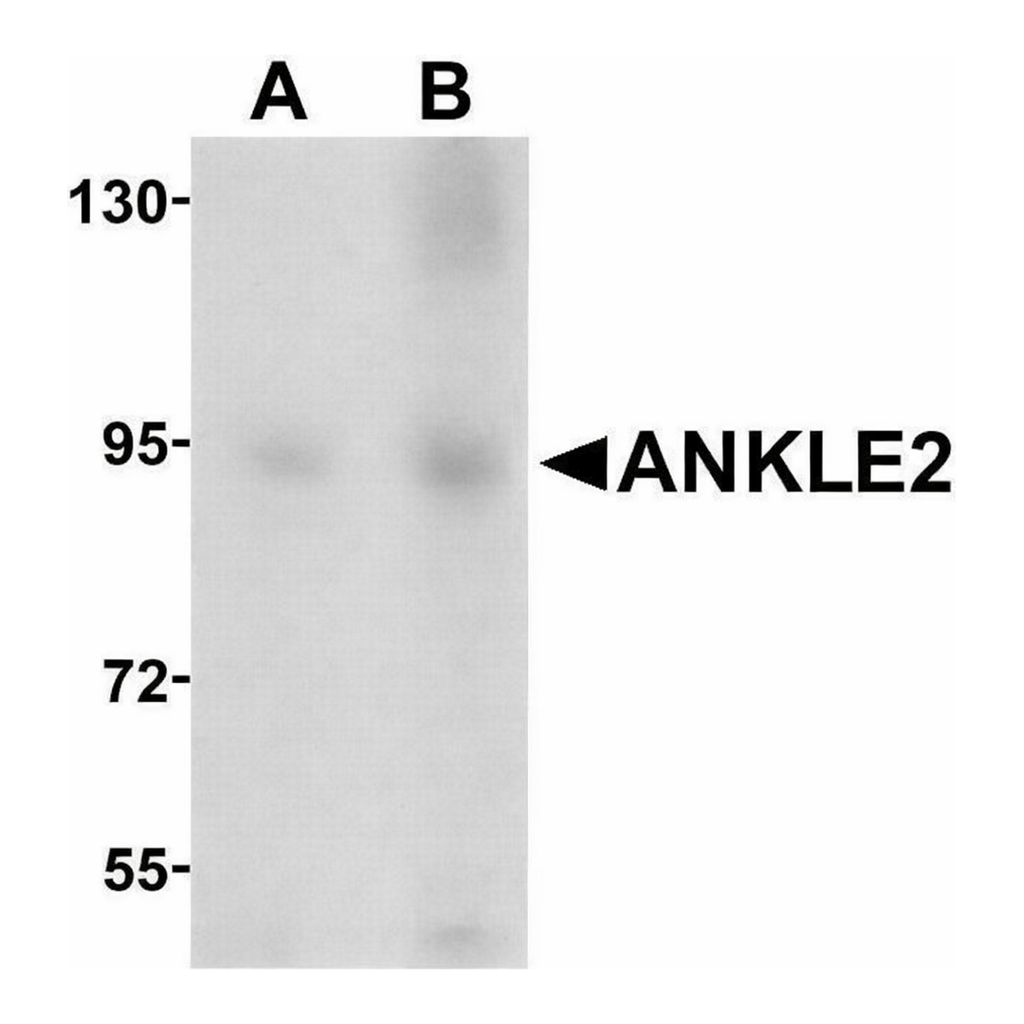 Merck Anti-ANKLE2 antibody produced in chicken