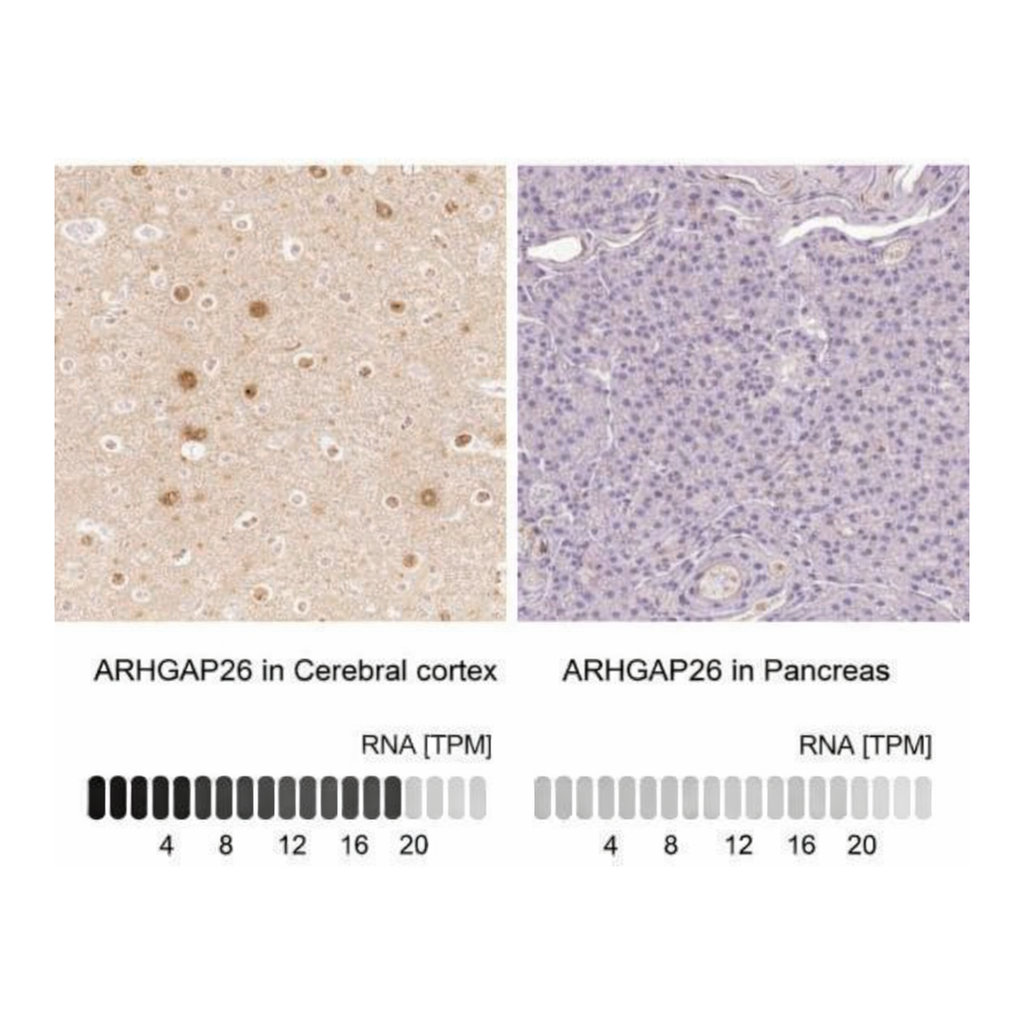 Merck Anti-ARHGAP26 antibody produced in rabbit