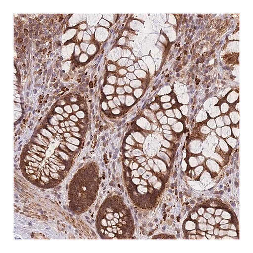 Merck Anti-MRPL23 antibody produced in rabbit