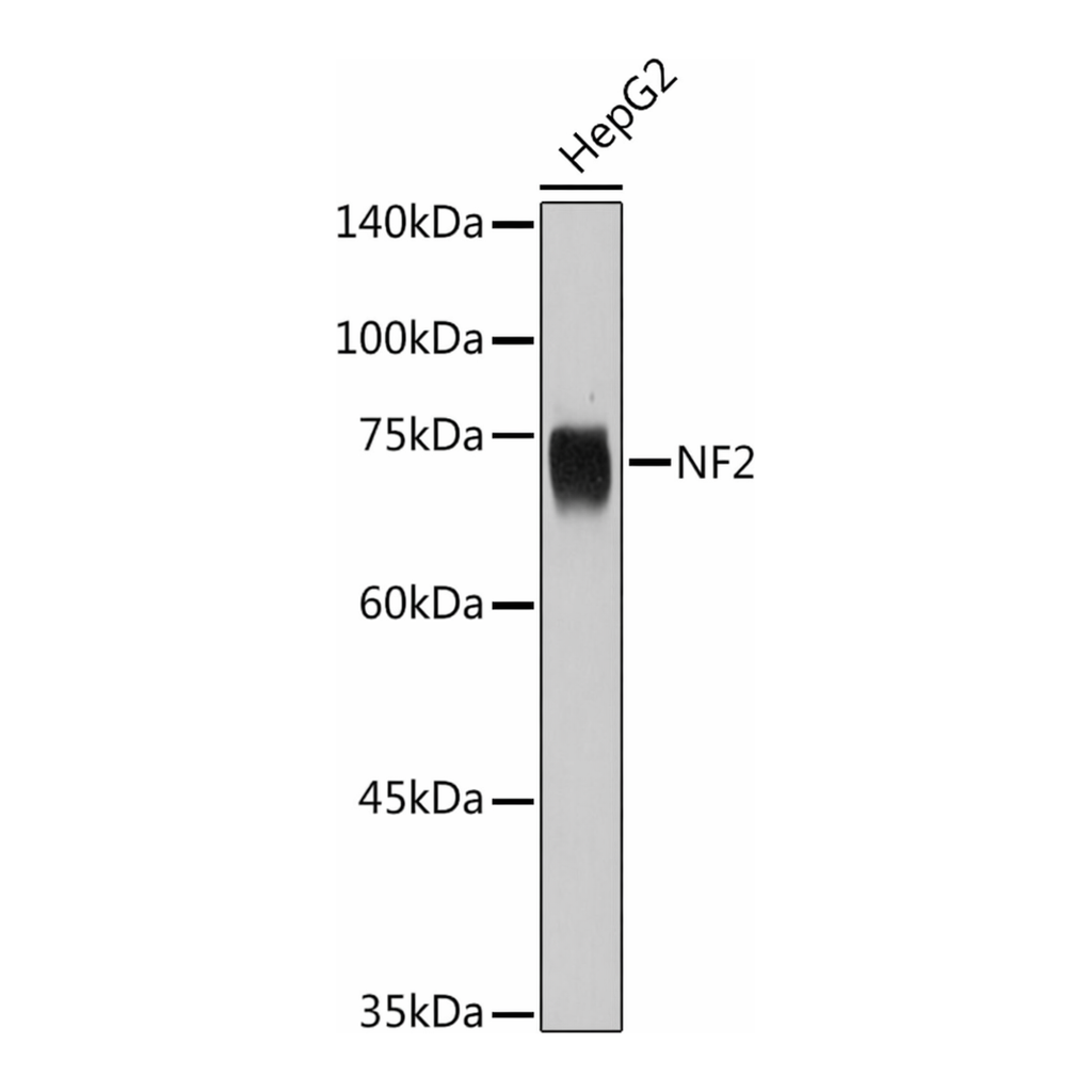 Merck Anti- NF2 antibody produced in rabbit