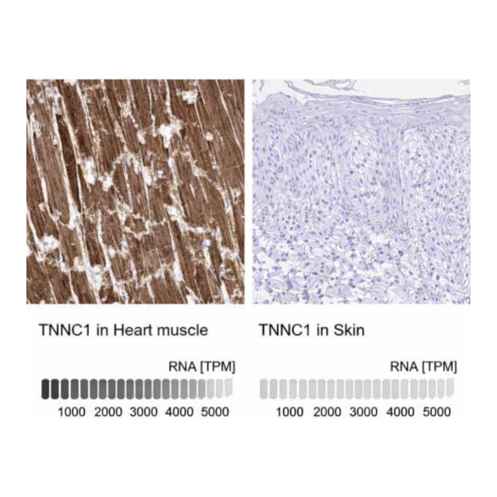 Merck Anti-TNNC1 antibody produced in rabbit