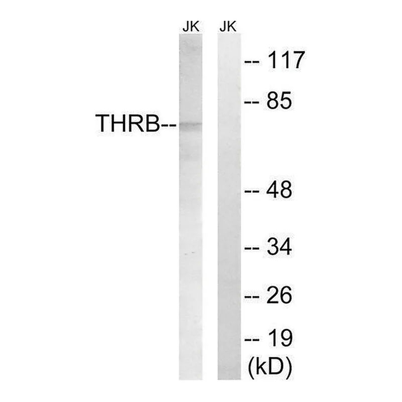 Merck Anti-THRB (AP2, Cleaved-Arg327) antibody produced in rabbit