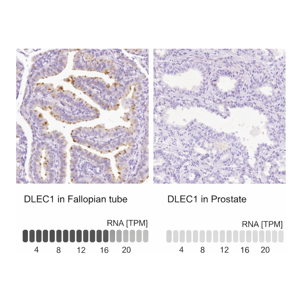 Merck Anti-DLEC1 antibody produced in rabbit