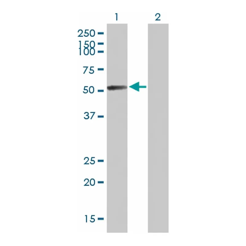 Merck Anti-GALNS antibody produced in mouse