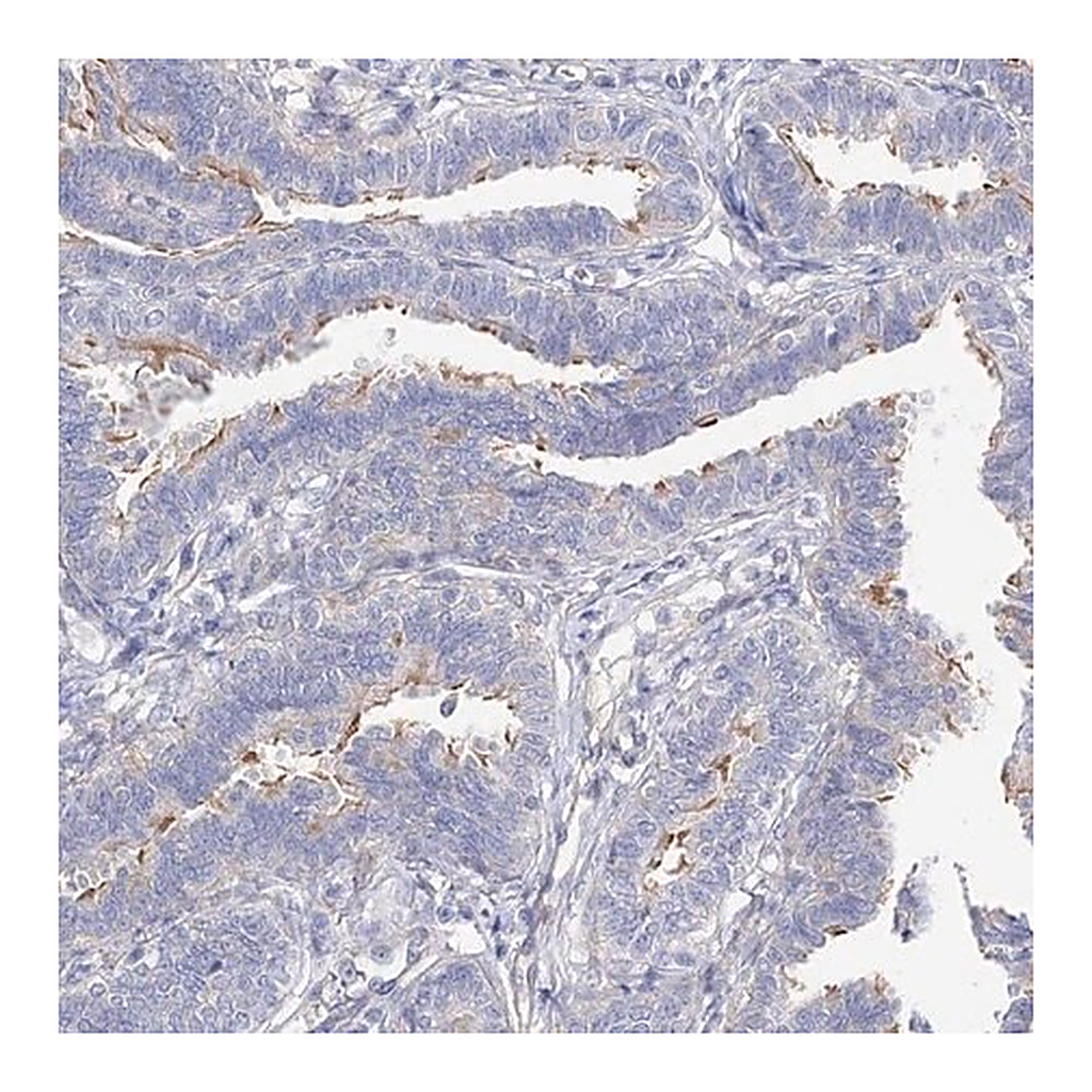 Merck Anti-LCA5 antibody produced in rabbit