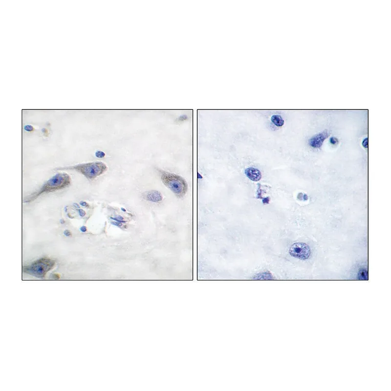 Merck Anti-DARPP-32 antibody produced in rabbit