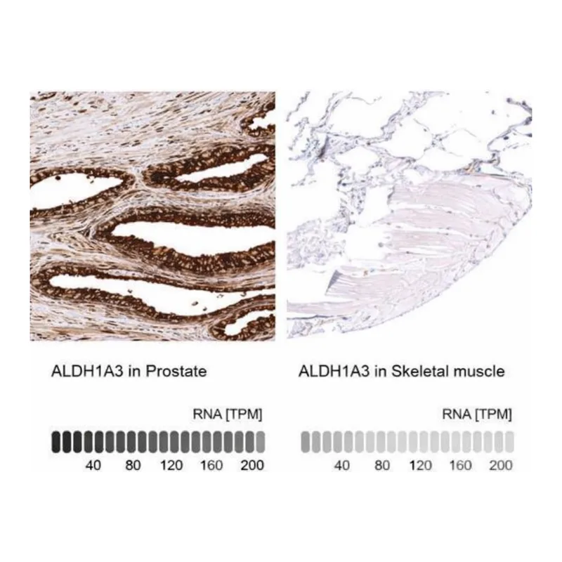 Merck Monoclonal Anti-ALDH1A3 antibody produced in mouse