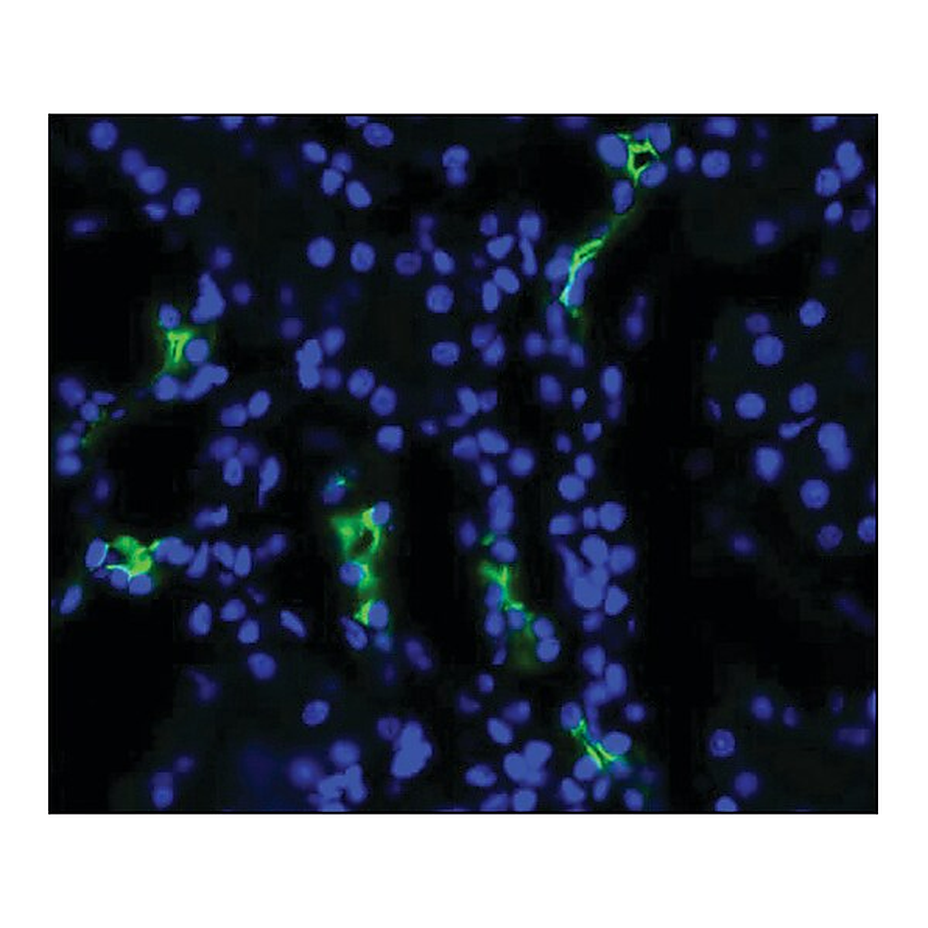 Merck Anti-AQP2 antibody produced in rabbit