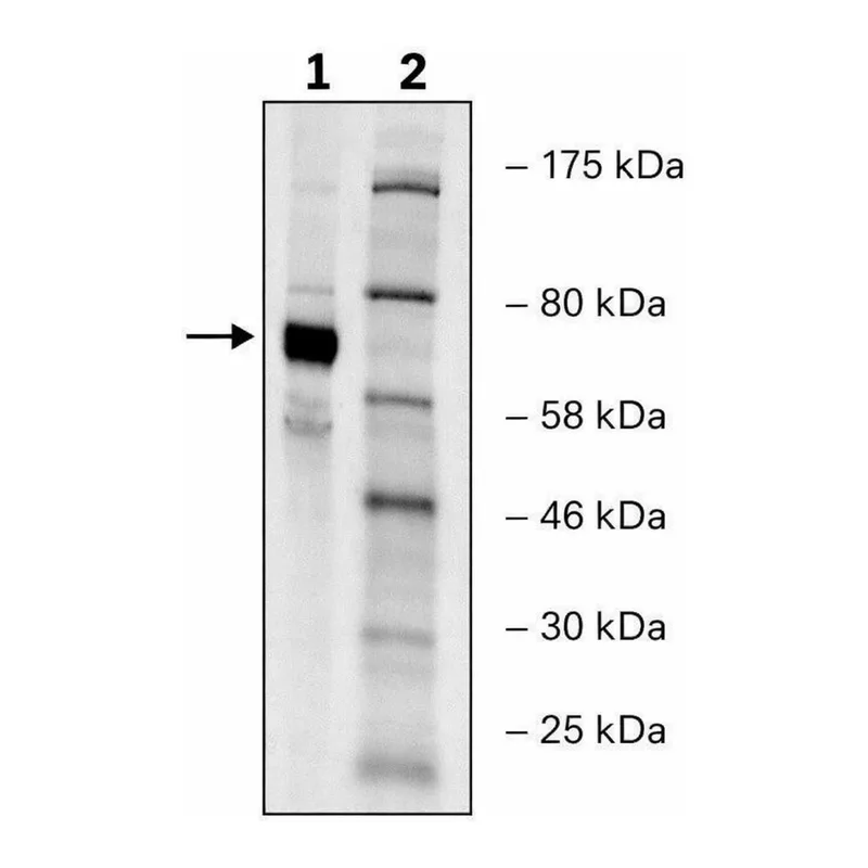 Merck PADI-4 human