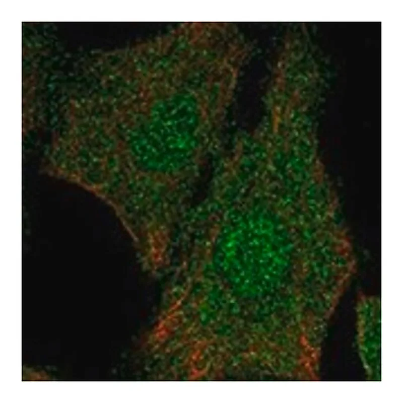 Merck Anti-ELP5 antibody produced in rabbit