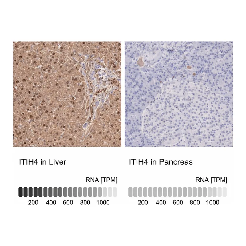 Merck Anti-ITIH4 antibody produced in rabbit