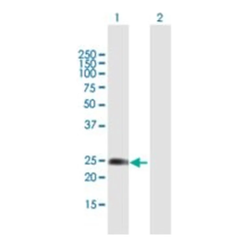 Merck ANTI-WISP2