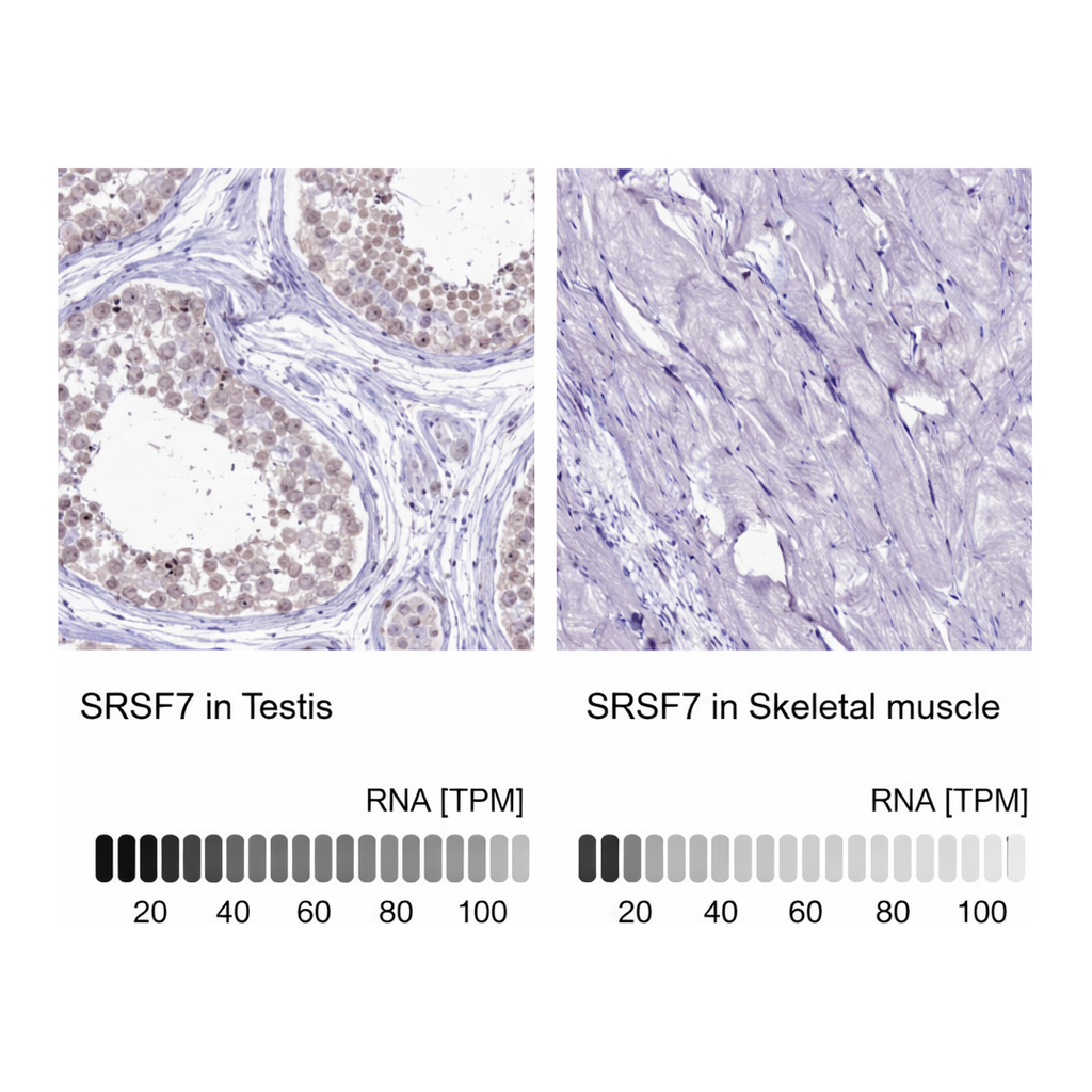 Merck Anti-SRSF7 antibody produced in rabbit