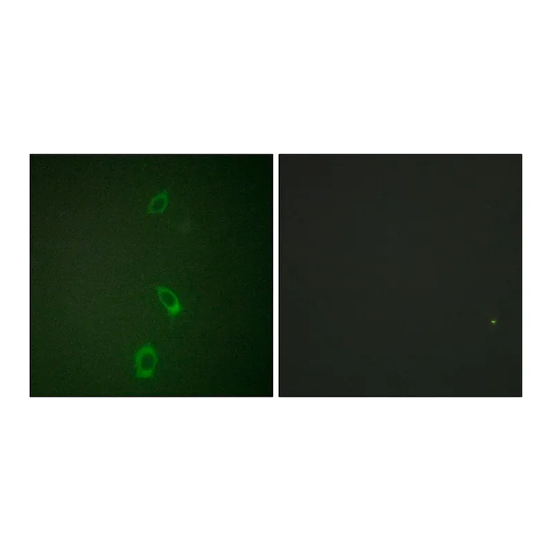 Merck Anti-ROMK antibody produced in rabbit