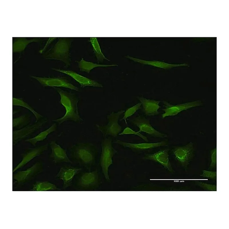 Merck Monoclonal Anti-MAGEA3 antibody produced in mouse