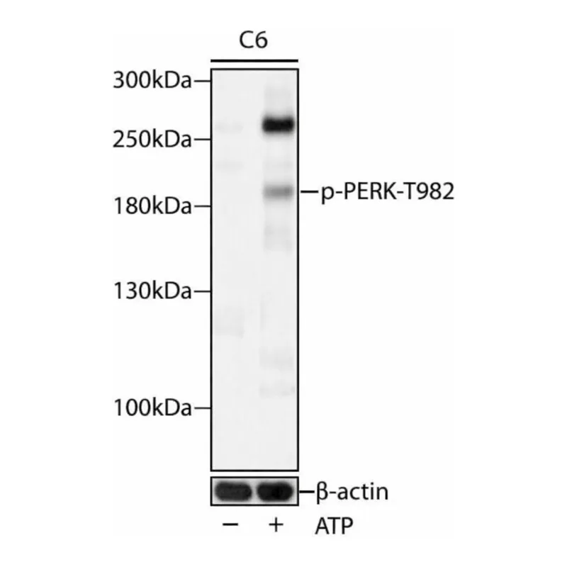 Merck ANTI-PHOSPHO-PERK-T982 ANTIBODY PRODUCE&