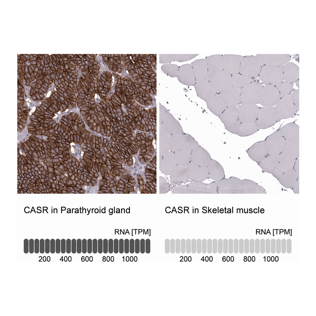 Merck Anti-CASR antibody produced in rabbit