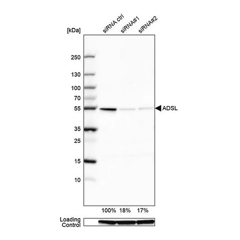 Merck Anti-ADSL antibody produced in rabbit