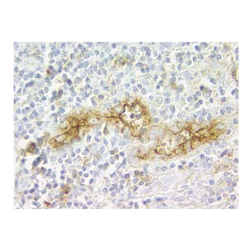 BD Purified Rat Anti-Human Cutaneous Lymphocyte Antigen