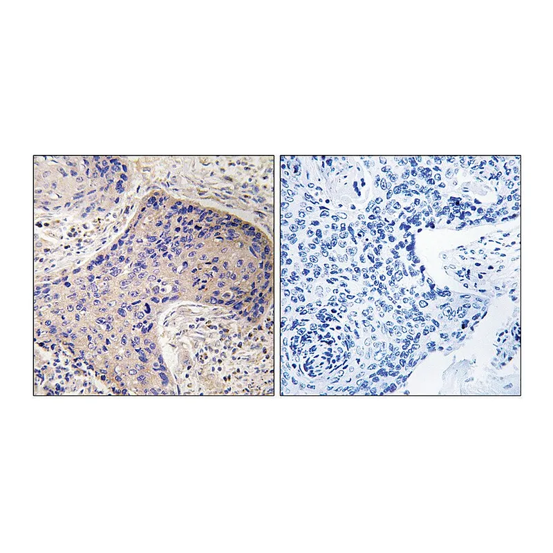 Merck Anti-ST6GAL1 antibody produced in rabbit