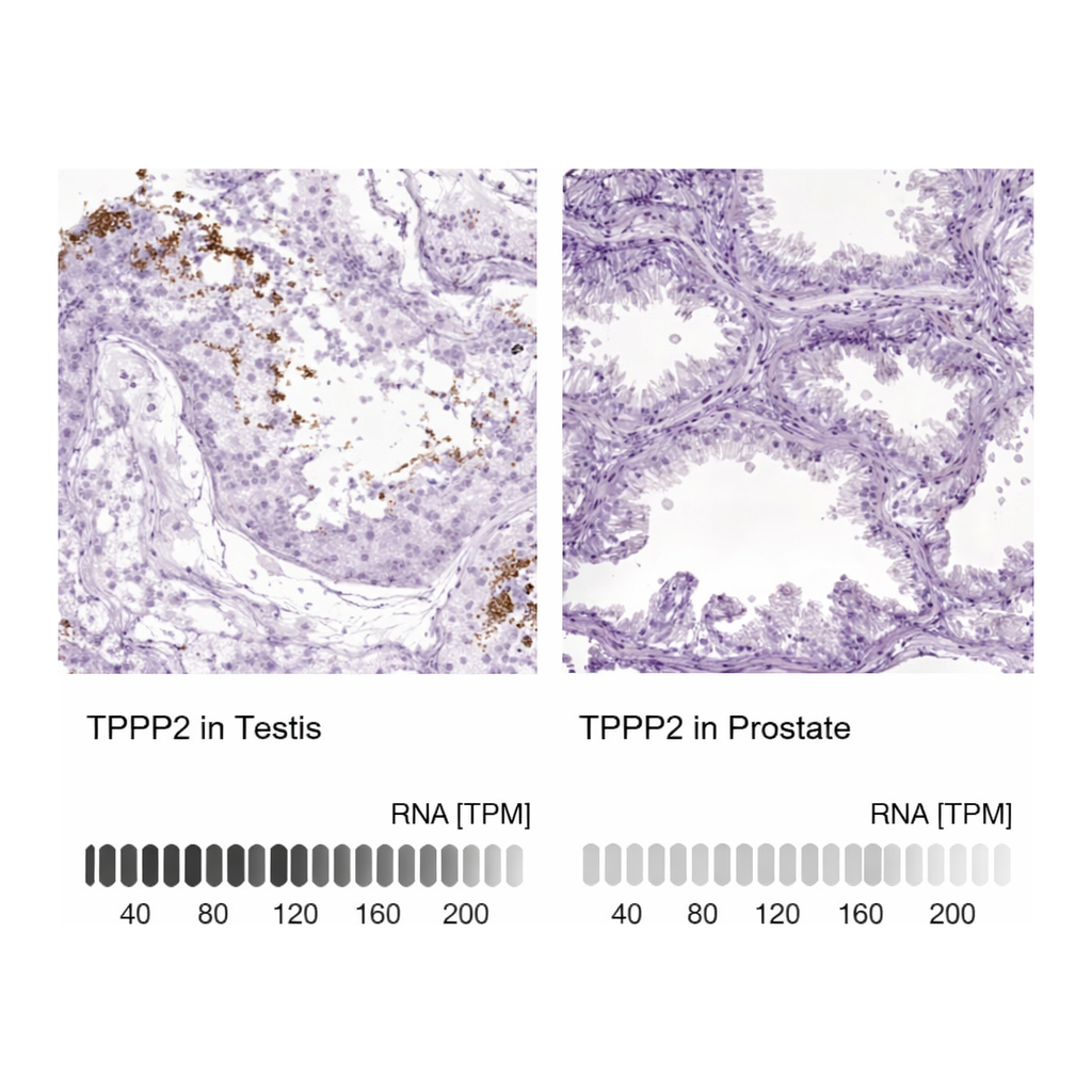 Merck Anti-TPPP2 antibody produced in rabbit