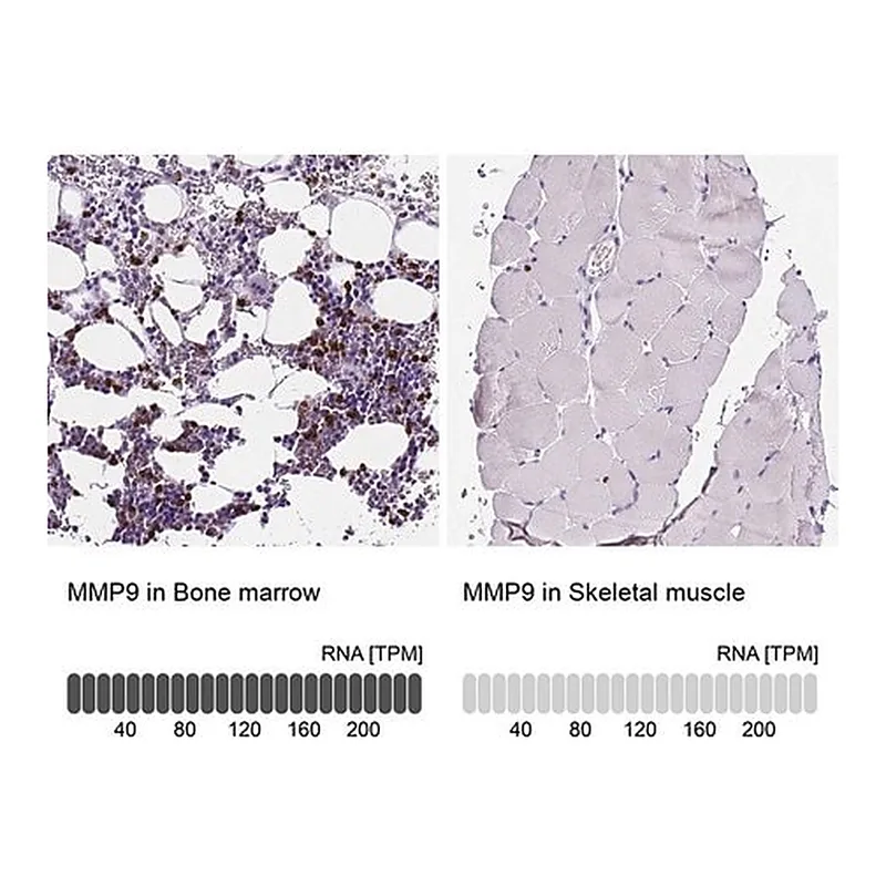 Merck Anti-MMP9 antibody produced in rabbit