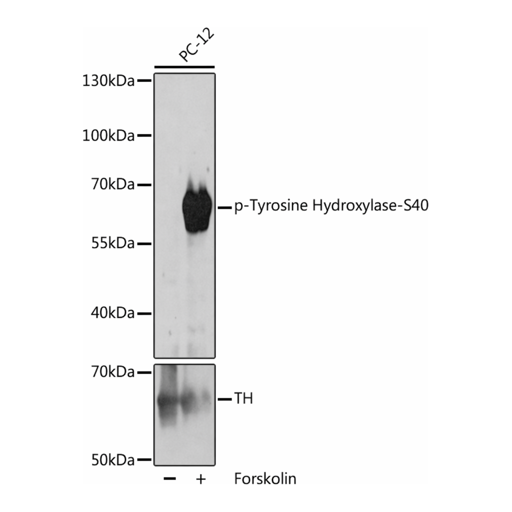 Merck Anti-Phospho-Tyrosine Hydroxylase-S40 antibody produced in rabbit