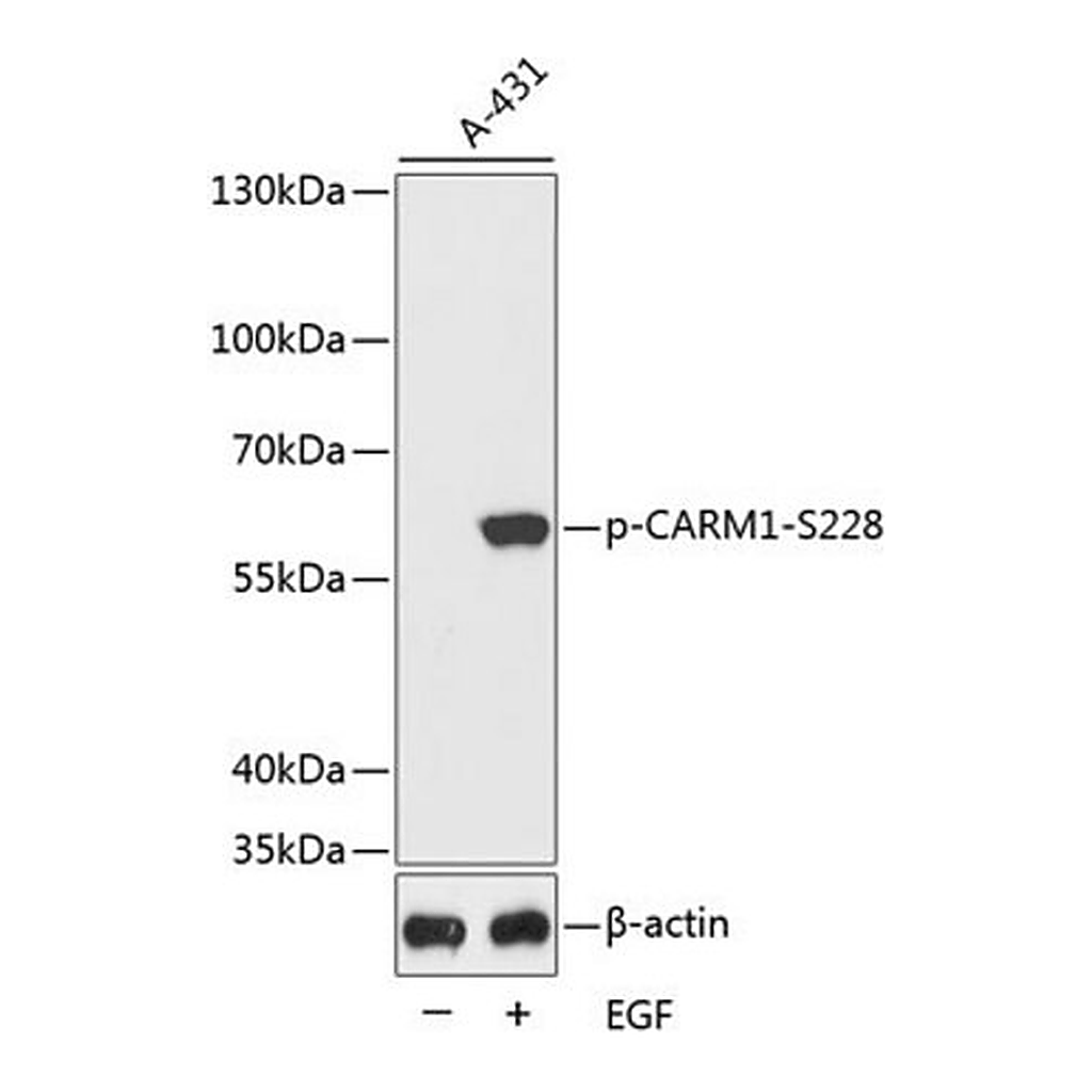 Merck Anti-Phospho-CARM1-S228 antibody produced in rabbit