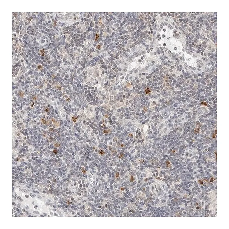 Merck Anti-PARP10 antibody produced in rabbit