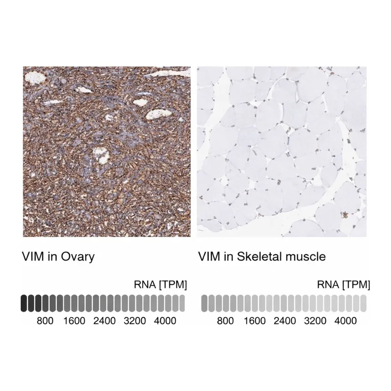 Merck Anti-VIM antibody produced in rabbit