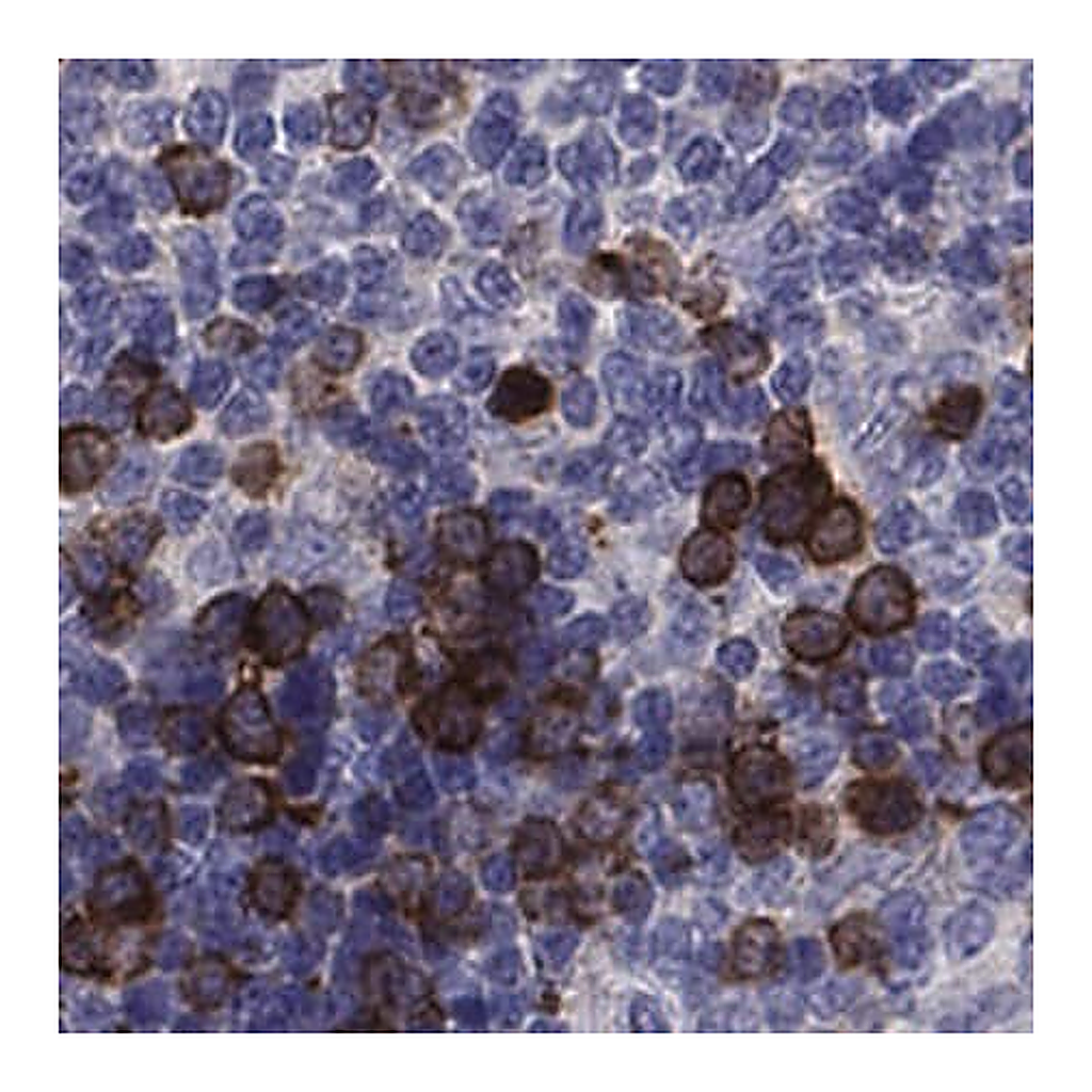 Merck Anti-KIF15 antibody produced in rabbit