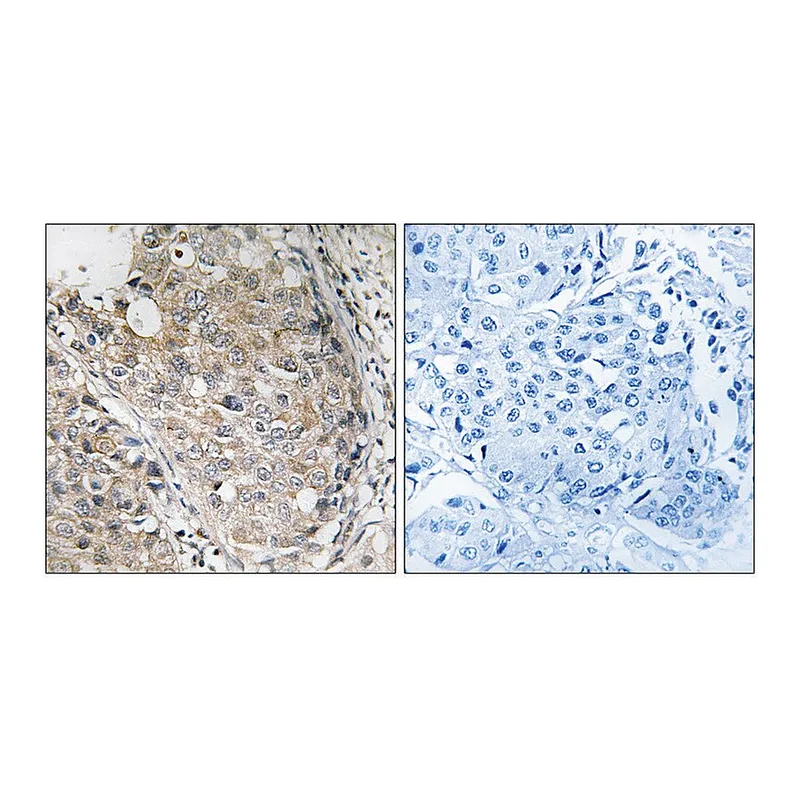 Merck Anti-MKP-1 antibody produced in rabbit