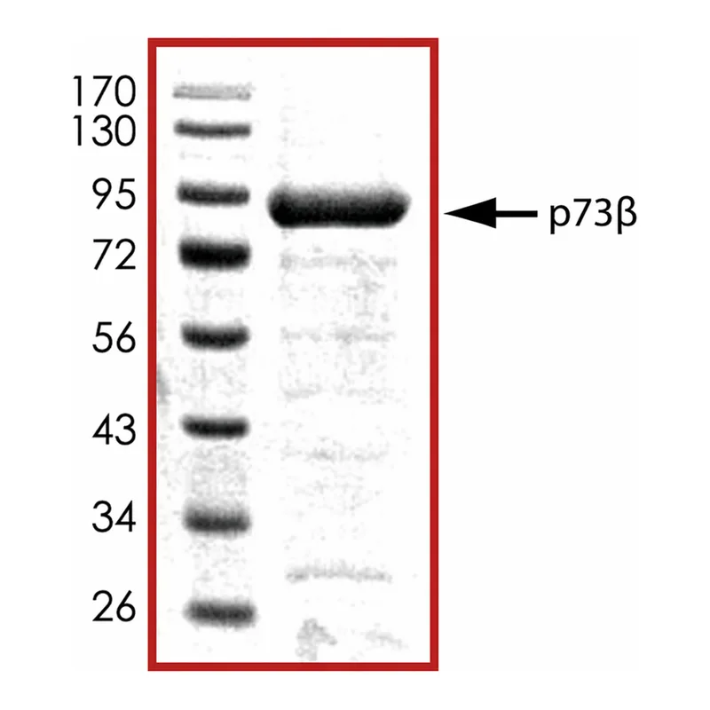 Merck P73b, GST tagged human