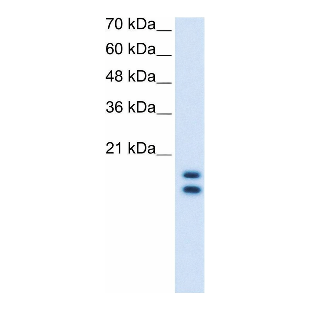 Merck Anti-UXT (AB2) antibody produced in rabbit
