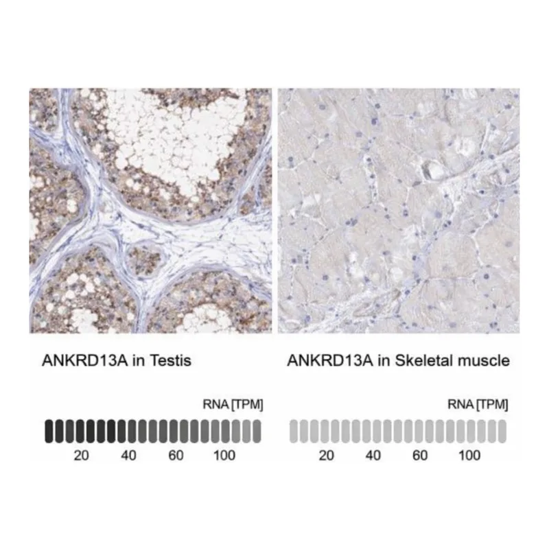Merck Anti-ANKRD13A antibody produced in rabbit