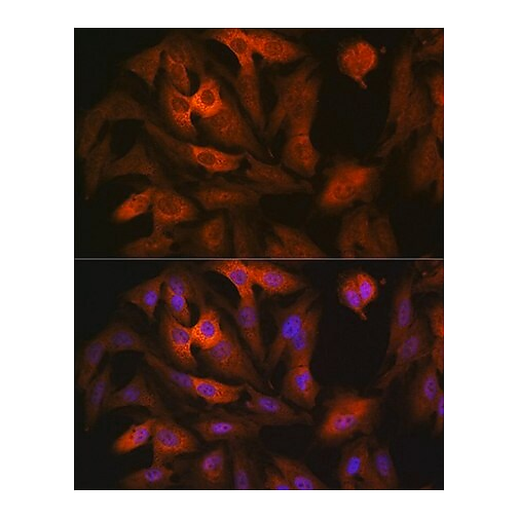 Merck Anti-AGR2 antibody produced in rabbit