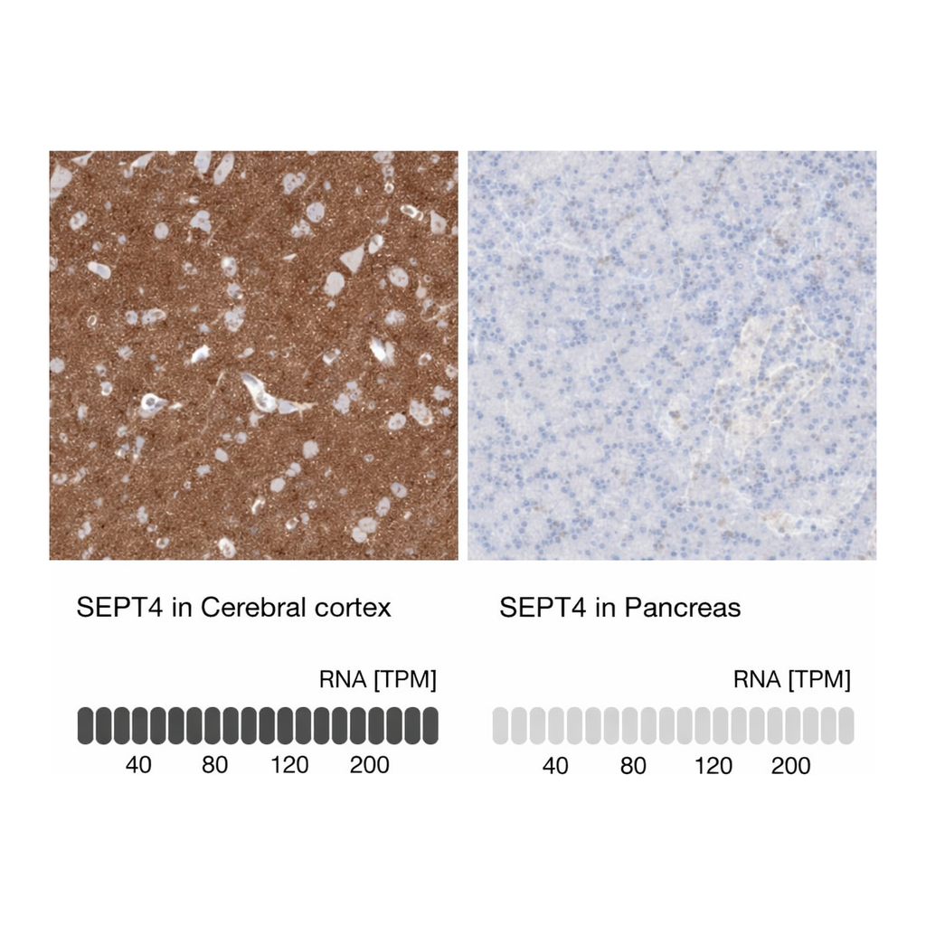 Merck Anti-SEPT4 antibody produced in rabbit