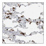 Merck ANTI-AC068020.1