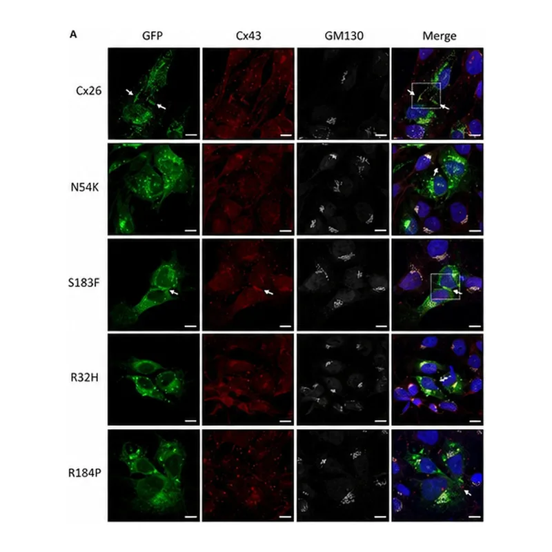 Thermo Fisher Scientific Goat anti-Mouse IgG (H+L) Highly Cross-Adsorbed Secondary Antibody, Alexa Fluor 633