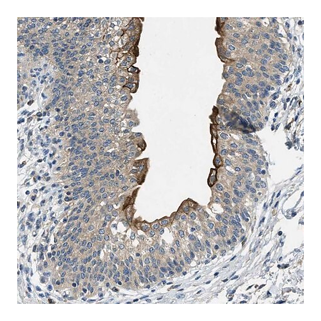 Merck Anti-RIPK2 antibody produced in rabbit