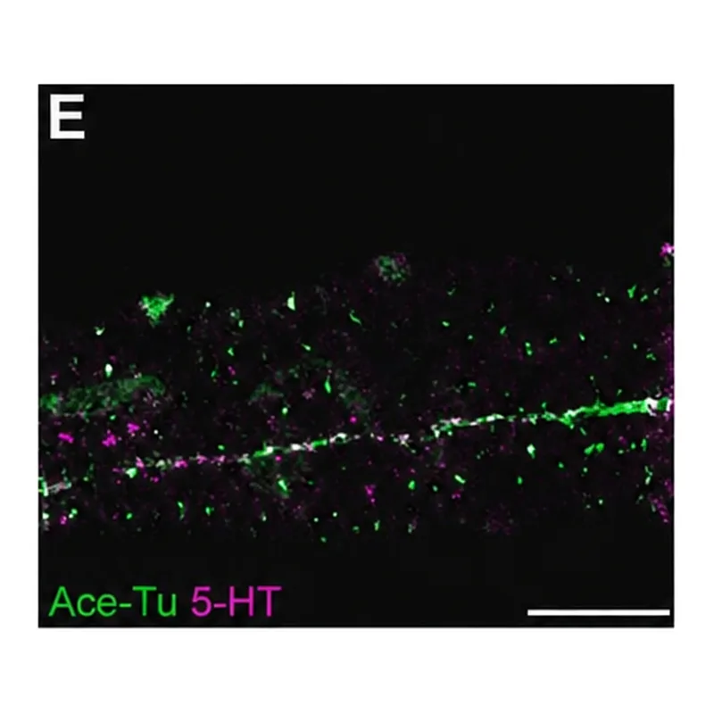 Merck NTI-SEROTONIN DEVELOPED IN RABBIT