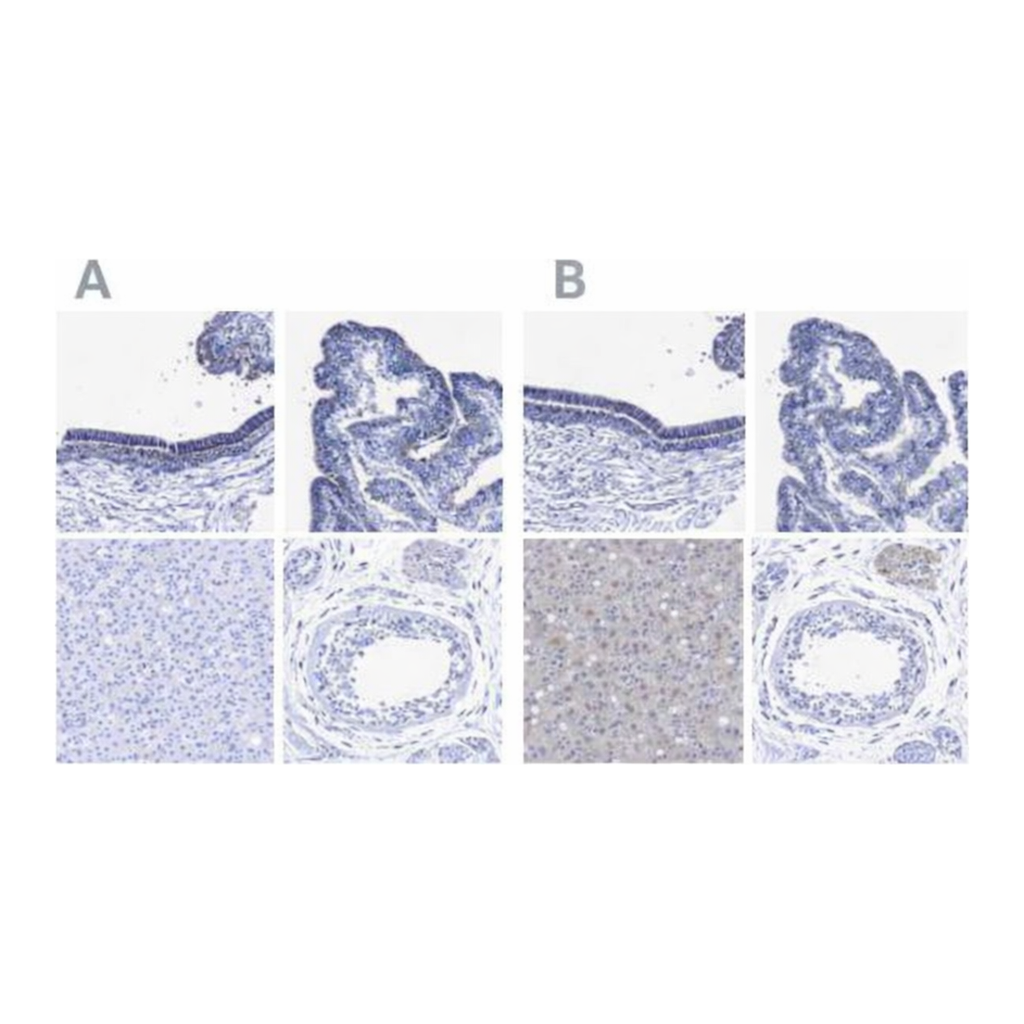 Merck Anti-CROCC antibody produced in rabbit