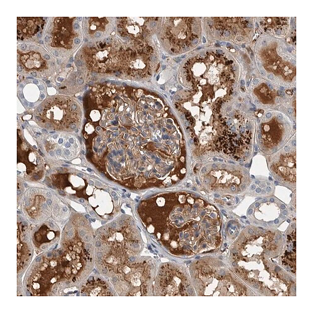 Merck Anti-SERPINC1 antibody produced in rabbit
