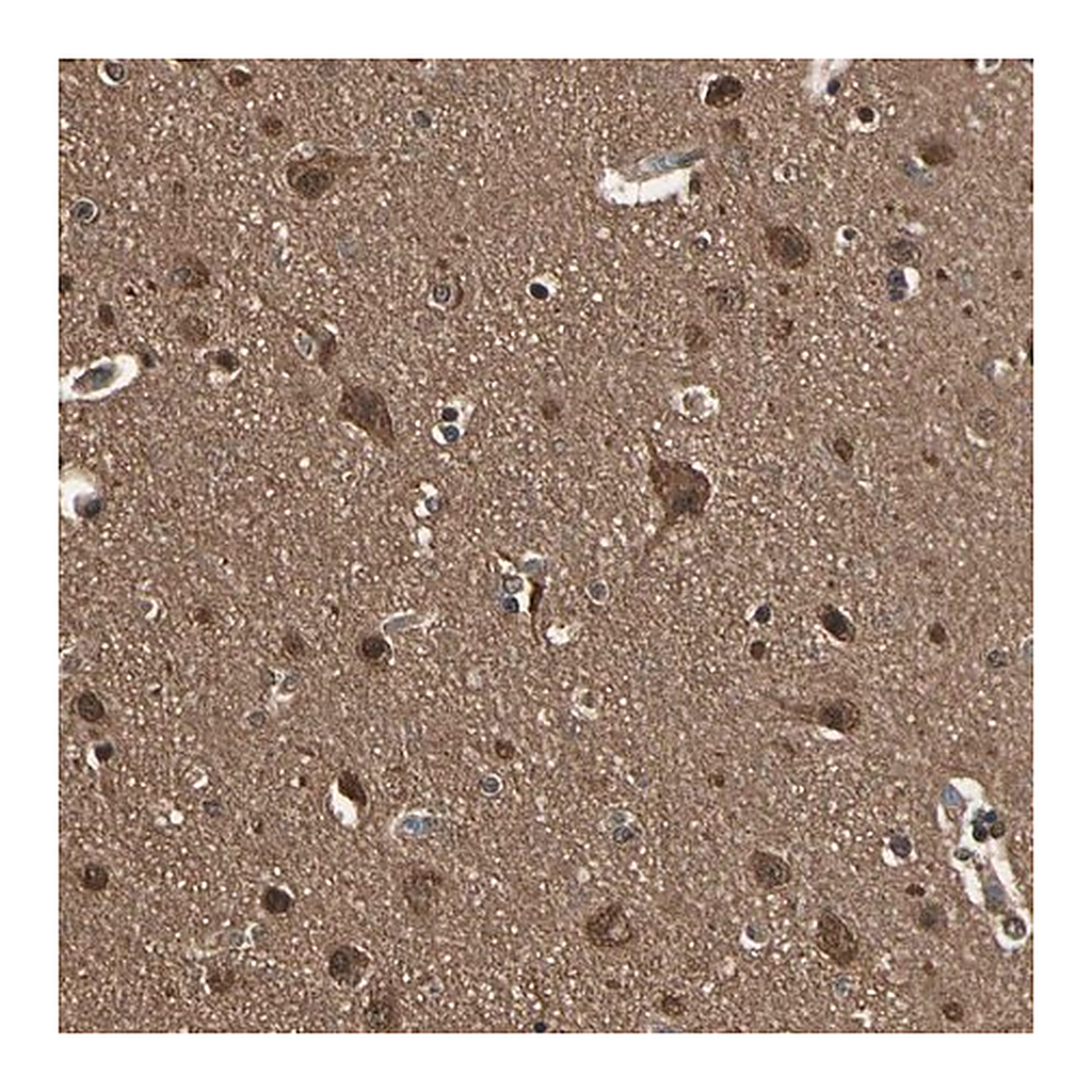 Merck Anti-YWHAE antibody produced in rabbit