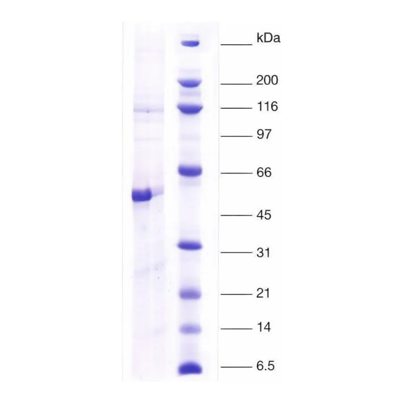 Merck Thyroid Hormone receptor,alpha1 human